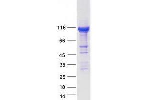 Image no. 1 for Spermatogenesis Associated 5 (SPATA5) protein (Myc-DYKDDDDK Tag) (ABIN2732530)