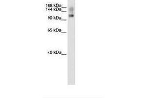 Image no. 1 for anti-Splicing Factor, Suppressor of White-Apricot Homolog (SFSWAP) (N-Term) antibody (ABIN204961)