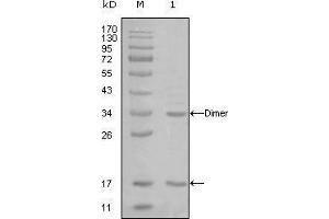 Image no. 1 for anti-E1A Binding Protein P300 (EP300) antibody (ABIN969098)