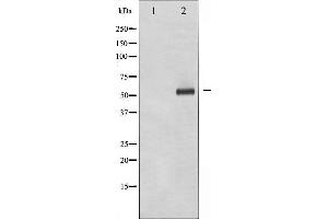 Image no. 1 for anti-DOK2 (DOK2) (pTyr299) antibody (ABIN6256703)