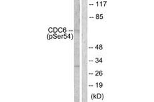 Western blot analysis of extracts from COS7 cells treated with EGF 200ng/ml 30', using CDC6 (Phospho-Ser54) Antibody.