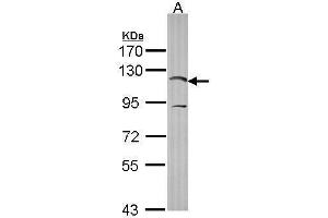 Image no. 2 for anti-Phosphoinositide-3-Kinase, Catalytic, alpha Polypeptide (PIK3CA) (N-Term) antibody (ABIN2854758)