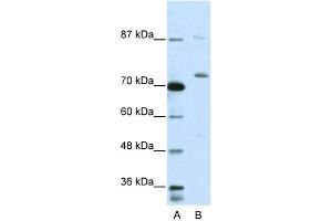 EXOSC10 antibody  (C-Term)