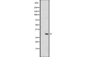 Image no. 3 for anti-Olfactory Receptor, Family 6, Subfamily C, Member 75 (OR6C75) antibody (ABIN6259252)