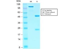 Image no. 1 for anti-SRY (Sex Determining Region Y)-Box 10 (SOX10) (AA 115-269) antibody (ABIN6940628)