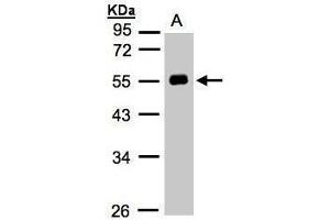 Image no. 5 for anti-Angiotensinogen (serpin Peptidase Inhibitor, Clade A, Member 8) (AGT) (Center) antibody (ABIN2855709)