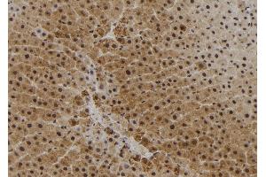 Image no. 1 for anti-RPTOR Independent Companion of mTOR, Complex 2 (RICTOR) (pSer1591) antibody (ABIN6270234)