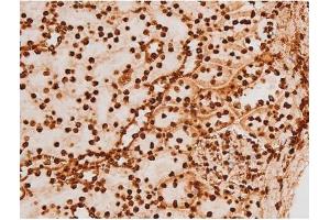 Image no. 11 for anti-REL proto-oncogene (c-Rel) (pSer503) antibody (ABIN6255382)