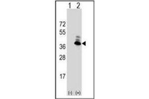 Image no. 5 for anti-Aspartoacylase (ASPA) (AA 89-118), (N-Term) antibody (ABIN452768)
