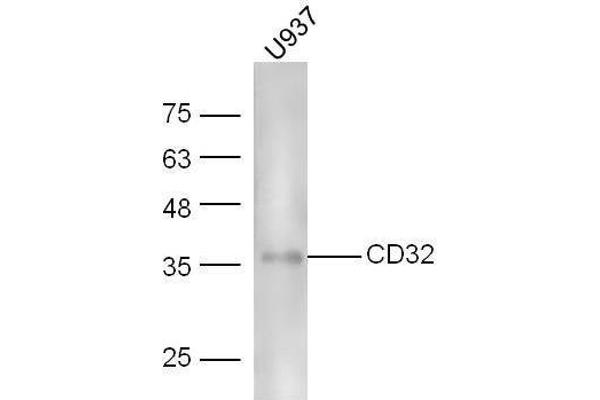 Fc gamma RII (CD32) (AA 201-300) anticorps