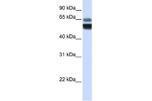 Image no. 1 for anti-Sphingomyelin phosphodiesterase 1, Acid Lysosomal (SMPD1) (Middle Region) antibody (ABIN635693)