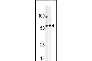 Image no. 1 for anti-Myelin Transcription Factor 1 (MYT1) (AA 452-482), (C-Term) antibody (ABIN5532623)