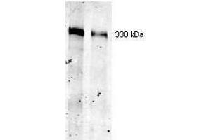 Western blot using ROCKLAND Immunochemical's Mouse Mab-anti-Thyroglobulin antibody.