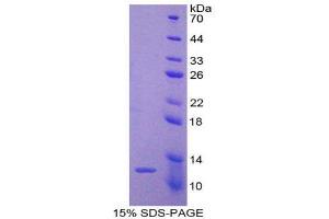 Image no. 1 for Peroxisomal Biogenesis Factor 2 (PEX2) (AA 233-305) protein (His tag,T7 tag) (ABIN1878645)