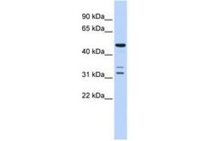 Image no. 1 for anti-HtrA Serine Peptidase 4 (HTRA4) (AA 396-445) antibody (ABIN6741359)