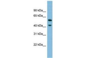 Image no. 1 for anti-Dihydrouridine Synthase 1-Like (DUS1L) (AA 359-408) antibody (ABIN6745180)