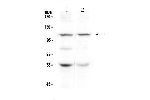 Image no. 1 for anti-Dihydropyrimidine Dehydrogenase (DPYD) (AA 356-511) antibody (ABIN5693320)