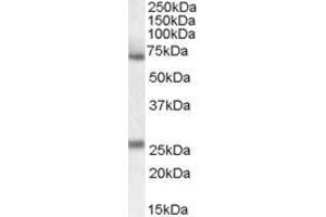 Image no. 2 for anti-Alpha2 Antiplasmin (SERPINF2) (Internal Region) antibody (ABIN334343)