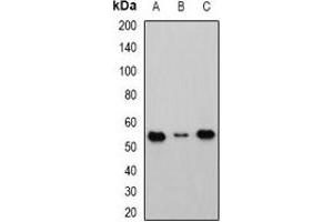 Image no. 2 for anti-Cbl proto-oncogene C (CBLC) antibody (ABIN2966499)