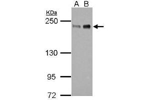 Image no. 2 for anti-Zinc Finger E-Box Binding Homeobox 1 (ZEB1) (Internal Region) antibody (ABIN2856075)