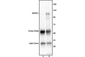 Image no. 2 for anti-Nuclear Factor of Activated T-Cells, Cytoplasmic, Calcineurin-Dependent 2 (NFAT1) (N-Term) antibody (ABIN6972419)