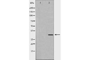 Image no. 2 for anti-Hepatitis A Virus Cellular Receptor 2 (TIM 3) antibody (ABIN6262151)