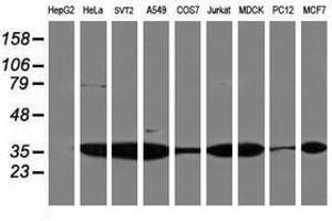 Image no. 3 for anti-Proteasome Subunit alpha 4 (PSMA4) antibody (ABIN1500458)
