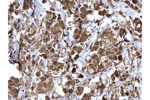 Image no. 2 for anti-Nuclear Factor-kB p65 (NFkBP65) (Center) antibody (ABIN2855287)