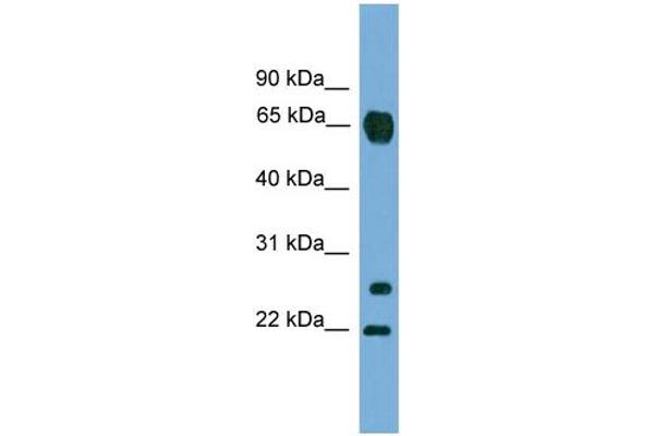 anti-Matrix Metallopeptidase 26 (MMP26) (C-Term) antibody