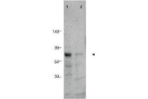 Image no. 1 for anti-CCCTC-Binding Factor (Zinc Finger Protein)-Like (CTCFL) (AA 9-26) antibody (ABIN129668)