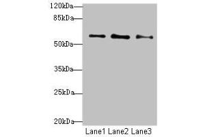 Western blot All lanes: GPR101 antibody at 6 μg/mL Lane 1: MCF-7 whole cell lysate Lane 2: U87 whole cell lysate Lane 3: Caco-2 whole cell lysate Secondary Goat polyclonal to rabbit IgG at 1/10000 dilution Predicted band size: 57 kDa Observed band size: 57 kDa