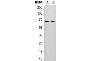 Image no. 2 for anti-Splicing Factor 1 (SF1) (N-Term), (pSer82) antibody (KLH) (ABIN2972767)