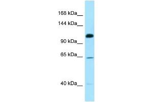 Image no. 1 for anti-SMC6 Structural Maintenance of Chromosomes 6-Like 1 (SMC6) (C-Term) antibody (ABIN2789722)
