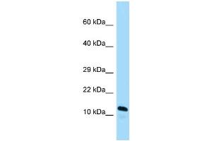 Image no. 1 for anti-ADP-Ribosylation Factor-Like 2 Binding Protein (ARL2BP) (C-Term) antibody (ABIN2789062)