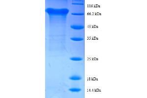 Image no. 1 for Eukaryotic Translation Initiation Factor 4A2 (EIF4A2) (AA 1-407), (full length) protein (GST tag) (ABIN5712053)