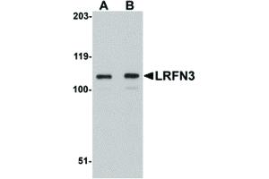 Image no. 1 for anti-Leucine Rich Repeat and Fibronectin Type III Domain Containing 3 (LRFN3) (Internal Region) antibody (ABIN6656259)
