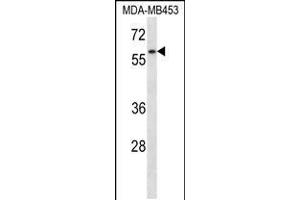 Image no. 1 for anti-Fanconi Anemia Complementation Group G (FANCG) (AA 540-568), (C-Term) antibody (ABIN5531155)