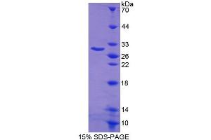 Image no. 1 for BCL2-Like 1 (BCL2L1) protein (His tag,HIS-T7) (ABIN1078941)