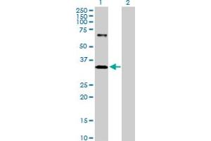 Image no. 1 for anti-Inositol(myo)-1(or 4)-Monophosphatase 1 (IMPA1) (AA 1-277) antibody (ABIN517150)