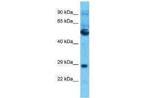 Image no. 1 for anti-Solute Carrier Family 13 Member 5 (SLC13A5) (Middle Region) antibody (ABIN5515174)