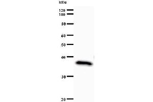 Image no. 2 for anti-Set1/Ash2 Histone Methyltransferase Complex Subunit ASH2 (ASH2L) antibody (ABIN933109)