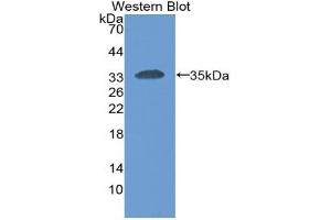 Image no. 1 for Carcinoembryonic Antigen-Related Cell Adhesion Molecule 1 (Biliary Glycoprotein) (CEACAM1) ELISA Kit (ABIN6730968)