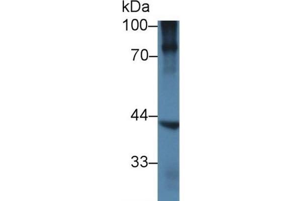 NKX6-1 antibody  (AA 1-367)