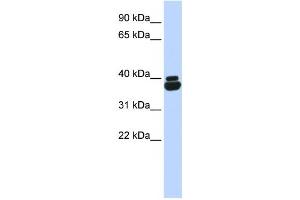 Image no. 1 for anti-Orthopedia Homeobox (OTP) antibody (ABIN2458104)