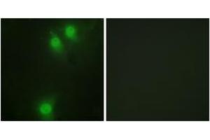 Immunofluorescence analysis of HeLa cells, using NEK9 (Phospho-Thr210) Antibody.