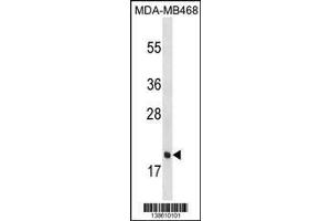 Image no. 1 for anti-Peptidoglycan Recognition Protein 1 (PGLYRP1) (AA 147-174), (C-Term) antibody (ABIN1536730)