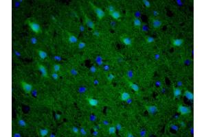 Image no. 2 for anti-Gem (Nuclear Organelle) Associated Protein 2 (GEMIN2) (AA 51-150) antibody (ABIN2174377)