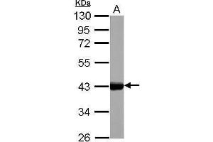 Image no. 2 for anti-Keratin 17 (KRT17) (Center) antibody (ABIN2855697)
