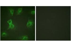 Immunofluorescence analysis of HeLa cells treated with Forskolin 40nM 15', using HRS (Phospho-Tyr334) Antibody.