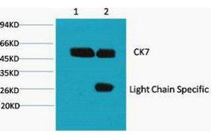 Image no. 4 for anti-Keratin 7 (KRT7) antibody (ABIN3181124)